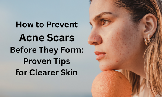 How to Prevent Acne Scars Before They Form: Proven Tips for Clearer Skin