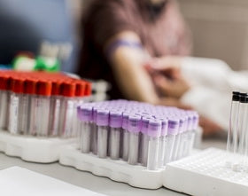 General Chemistry Reagent