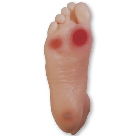 Diabetic Foot Model Set