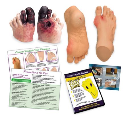 Diabetic Foot Care