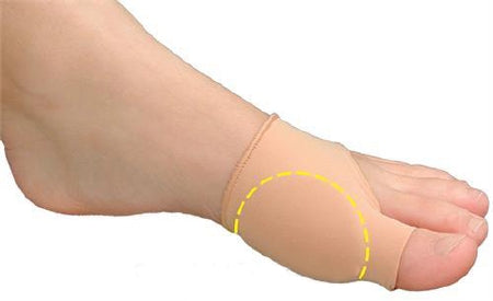 Bunion Sleeve Visco-GEL Bunion Care Large / X-Large Pull-On Foot
