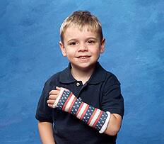 Cast Tape Delta-Cast Prints