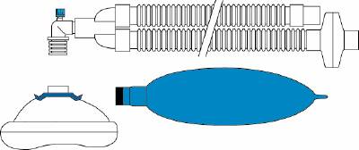 Portex Anesthesia Breathing Circuit Corrugated Tube 60 Inch Tube Dual Limb Pediatric 1 Liter Bag Single Patient Use
