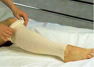 Stockinette Tubular Albahealth