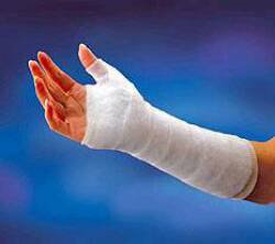 Cast Padding Undercast Protouch Natural