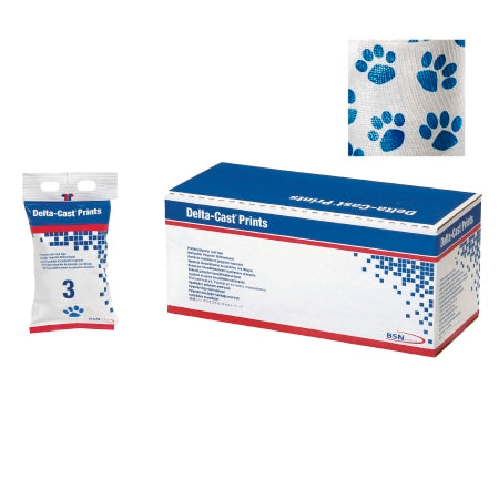 Cast Tape Delta-Cast Prints