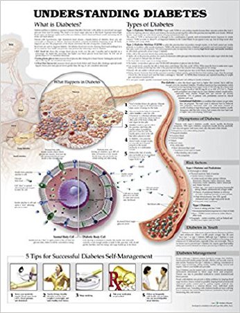 Anatomical Chart Type 1 Diabetes
