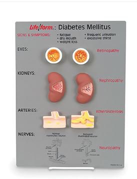 Diabetes Mellitus Teaching Kit Life