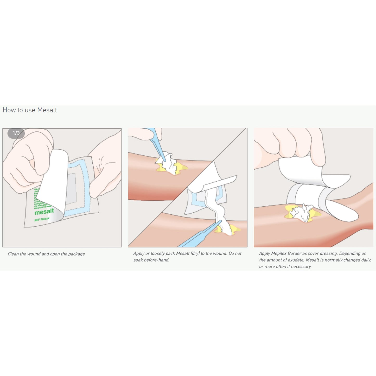 Mesalt Sodium Chloride Impregnated Dressing 8 x 8 Inch (4 x 4 Inch Folded) Sterile Gauze