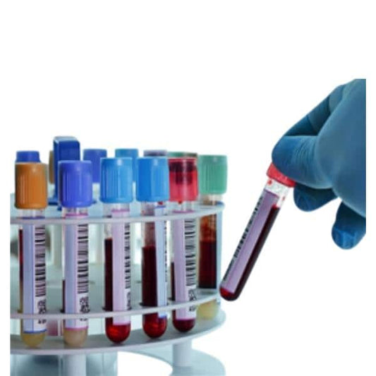General Chemistry Reagent – Glucose Hexokinase (For Hitachi 917 Analyzer)