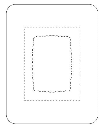 Transparent Film Dressing with Pad SorbaView 2000 5 X 6-1/2 Inch Frame Style Delivery Rectangle Sterile