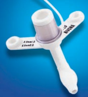 Cuffed Tracheostomy Tube Bivona TTS Size