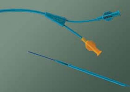 Ureteral Catheter