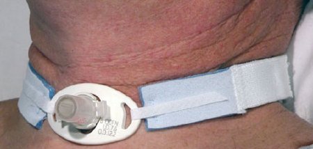 Tracheostomy Tube Holder AirLife 6.7 X 1 Inch Neonate / Pediatric