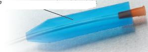 Urethral Catheter