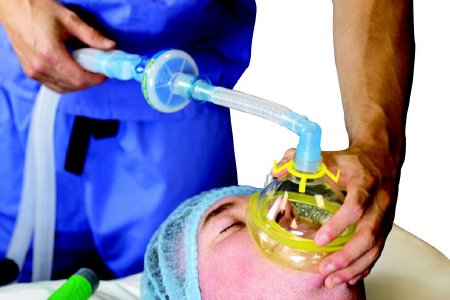 Flexicare Anesthesia Breathing Circuit Expandable Tube 96 Inch Tube Dual Limb Pediatric 1 Liter Bag Single Patient Use Jackson-Rees Circuit