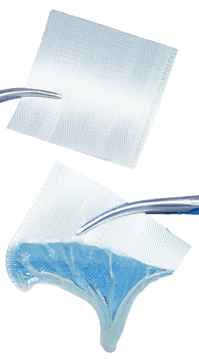 BloodSTOP iX Advanced Hemostat with WoundHEAL 1/2 x 2 Inch Sterile Hemostatic Gauze