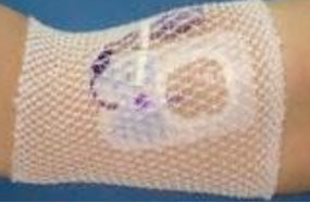ProNet Tubular Retainer Dressing Pre-Cut Gauze 10 Inch Size 7 – White Arm NonSterile