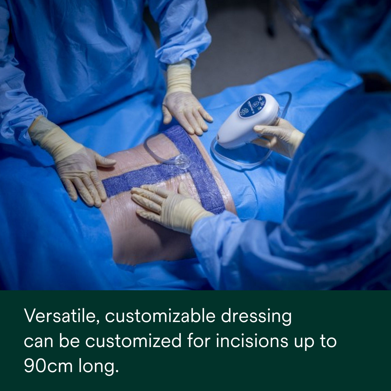 3M Prevena Plus Customizable Negative Pressure Dressing Kit 125 mmHg