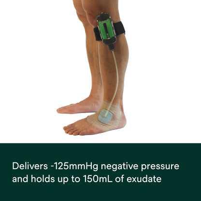SNAP Negative Pressure Wound Therapy Cartridge 125 mmHg, 60 mL – NPWT System Cartridge