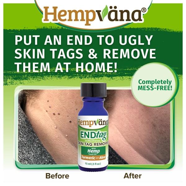 Hempvana EndTag Skin Tag Remover, Enriched with Hemp Seed Oil, Mess-Free, Easy & Painless Skin Tag Removal - Just Brush It On - Great for All Skin Types & Works In Sensitive Areas, 0.5 fl. oz.